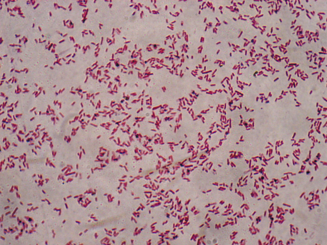 3_coli._gram__opt.jpeg
